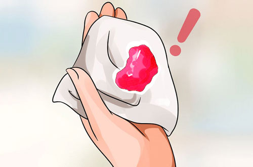 Máu báo thai và những điều mẹ cần lưu ý