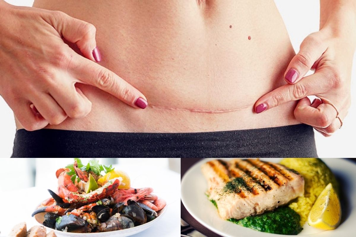 Phụ nữ sau sinh mổ nên ăn gì và kiêng gì để mẹ khỏe, nhiều sữa cho con?